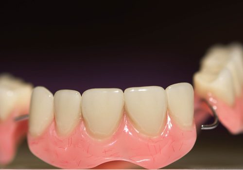 dental-prosthesis-on-dark-background-2022-11-09-06-51-09-utc-min