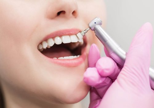 dentist-brushes-teeth-young-girl-teeth-whitening-2022-11-15-05-20-50-utc-min