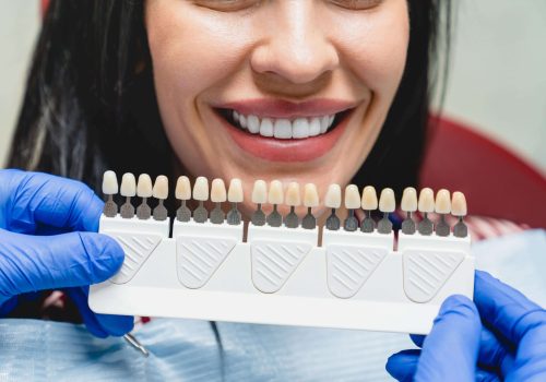 whitening-concept-dental-care-implants-veneers-2021-12-09-04-23-39-utc-min